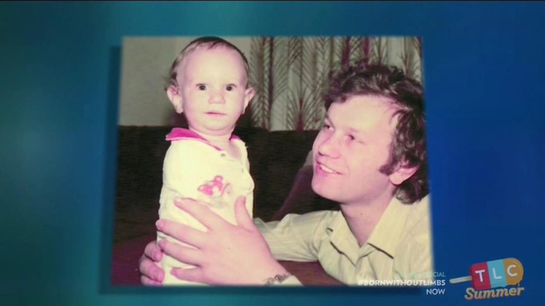 Otac Branislav i majka Dušanka bili su u šoku kad im je babica pokazala sina: Nije imao ni ruke, ni noge, a onda je usledio nezamisliv scenario - featured image Otac Branislav i majka Dušanka bili su u šoku kad im je babica pokazala sina: Nije imao ni ruke, ni noge, a onda je usledio nezamisliv scenario - featured image