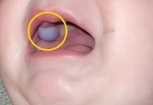 Majka je primetila nešto neobično u ustima svog devetomesečnog sina i odmah je otišla kod lekara — otkriće lekara bilo je iznenađujuće. Majka je primetila nešto neobično u ustima svog devetomesečnog sina i odmah je otišla kod lekara — otkriće lekara bilo je iznenađujuće. - featured image