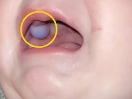 Majka je primetila nešto neobično u ustima svog devetomesečnog sina i odmah je otišla kod lekara — otkriće lekara bilo je iznenađujuće. Majka je primetila nešto neobično u ustima svog devetomesečnog sina i odmah je otišla kod lekara — otkriće lekara bilo je iznenađujuće. - featured image