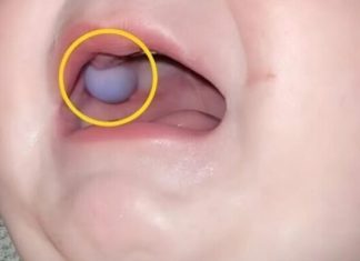 Majka je primetila nešto neobično u ustima svog devetomesečnog sina i odmah je otišla kod lekara — otkriće lekara bilo je iznenađujuće. Majka je primetila nešto neobično u ustima svog devetomesečnog sina i odmah je otišla kod lekara — otkriće lekara bilo je iznenađujuće. - featured image