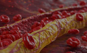 Ovi znaci na nogama pokazuju da imate izuzetno visok holesterol: Ne smijete ih ignorisati, posljedice su fatalne po tijelo Ovi znaci na nogama pokazuju da imate izuzetno visok holesterol: Ne smijete ih ignorisati, posljedice su fatalne po tijelo - featured image