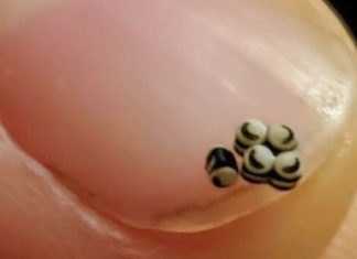 Tiha večera pretvorila se u noćnu moru kada smo u salati pronašli pomične crne točkice — ono što se dogodilo nakon toga odvelo nas je ravno u bolnicu Tiha večera pretvorila se u noćnu moru kada smo u salati pronašli pomične crne točkice — ono što se dogodilo nakon toga odvelo nas je ravno u bolnicu - featured image