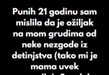 “Punih 21 godinu sam mislila da je ožiljak na mom grudima od neke nezgode iz detinjstva…” “Punih 21 godinu sam mislila da je ožiljak na mom grudima od neke nezgode iz detinjstva…” - featured image