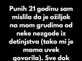 “Punih 21 godinu sam mislila da je ožiljak na mom grudima od neke nezgode iz detinjstva…” “Punih 21 godinu sam mislila da je ožiljak na mom grudima od neke nezgode iz detinjstva…” - featured image