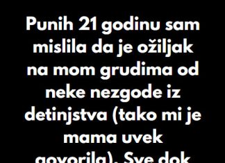 “Punih 21 godinu sam mislila da je ožiljak na mom grudima od neke nezgode iz detinjstva…” “Punih 21 godinu sam mislila da je ožiljak na mom grudima od neke nezgode iz detinjstva…” - featured image