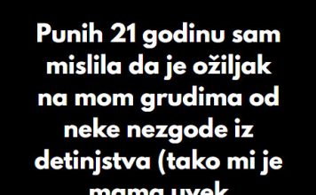 “Punih 21 godinu sam mislila da je ožiljak na mom grudima od neke nezgode iz detinjstva…” “Punih 21 godinu sam mislila da je ožiljak na mom grudima od neke nezgode iz detinjstva…” - featured image