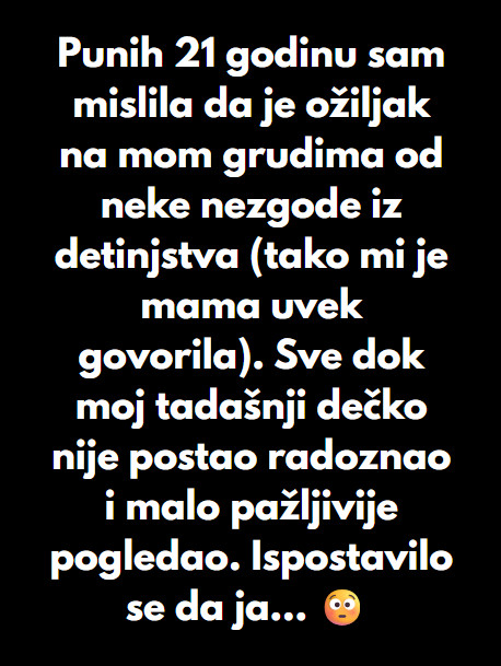 “Punih 21 godinu sam mislila da je ožiljak na mom grudima od neke nezgode iz detinjstva…” - featured image “Punih 21 godinu sam mislila da je ožiljak na mom grudima od neke nezgode iz detinjstva…” - featured image
