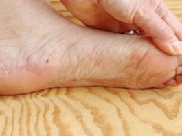 7 znakova da se tijelo već duže vrijeme bori s VISOKIM ŠEĆEROM U KRVI: Prvo ćete to primijetiti na očima i nogama! 7 znakova da se tijelo već duže vrijeme bori s VISOKIM ŠEĆEROM U KRVI: Prvo ćete to primijetiti na očima i nogama! - featured image