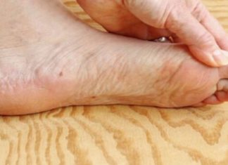 7 znakova da se tijelo već duže vrijeme bori s VISOKIM ŠEĆEROM U KRVI: Prvo ćete to primijetiti na očima i nogama! 7 znakova da se tijelo već duže vrijeme bori s VISOKIM ŠEĆEROM U KRVI: Prvo ćete to primijetiti na očima i nogama! - featured image