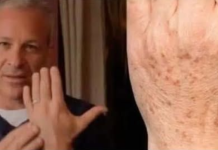 Sok od luka + jabukovo sirće: Samo pomiješajte i riješite se staračkih pjega narukama, licu i dekolteu jednom za svagda!