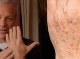 Sok od luka + jabukovo sirće: Samo pomiješajte i riješite se staračkih pjega narukama, licu i dekolteu jednom za svagda!