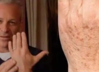 Sok od luka + jabukovo sirće: Samo pomiješajte i riješite se staračkih pjega narukama, licu i dekolteu jednom za svagda!