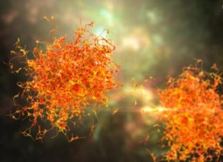 3 simptoma metastaze raka koji se javljaju rano ujutru: 0VAJ ZNAK JE crveni alaram, a svi ga zanemare … 3 simptoma metastaze raka koji se javljaju rano ujutru: 0VAJ ZNAK JE crveni alaram, a svi ga zanemare … - featured image