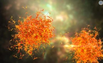 3 simptoma metastaze raka koji se javljaju rano ujutru: 0VAJ ZNAK JE crveni alaram, a svi ga zanemare … 3 simptoma metastaze raka koji se javljaju rano ujutru: 0VAJ ZNAK JE crveni alaram, a svi ga zanemare … - featured image