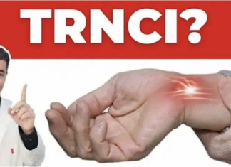 Zašto trnu prsti šake? OVO su najopasniji uzroci!