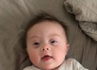 Kad se moja beba rodila s Downovim sindromom, potpisala sam papire da ga ostavim u bolnici… Ali dok sam odlazila, medicinska sestra potrčala je za mnom i rekla jednu rečenicu zbog koje sam se ukočila na mjestu 😱💔